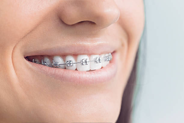 Emergency Dental Services in Bel Ridge, MO